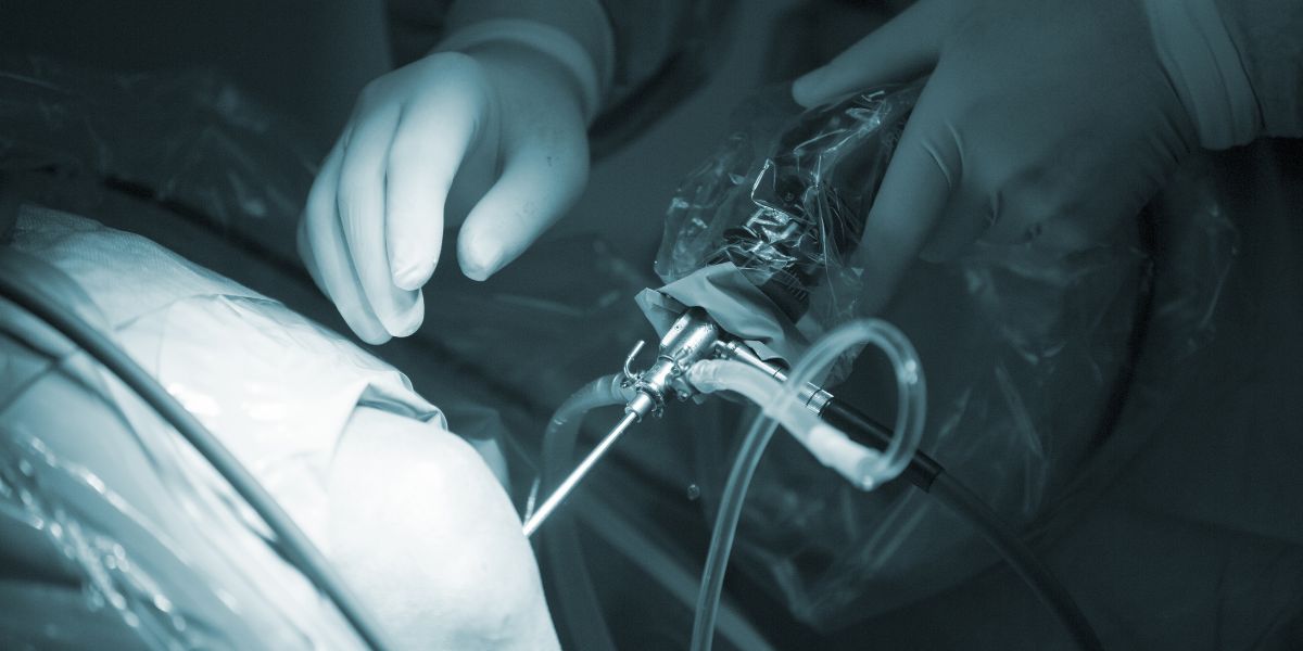 arthroscopy αρθροσκοπική χειρουργική